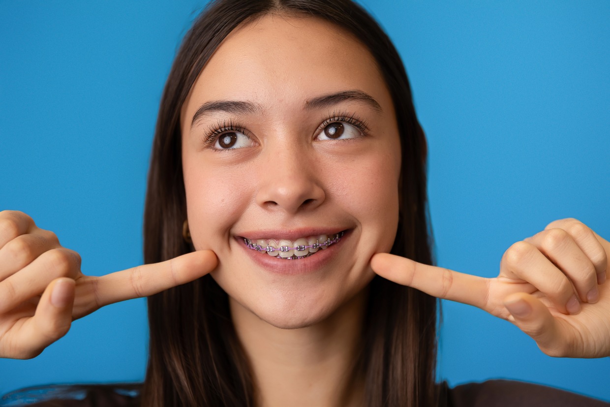 braces college station tx